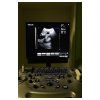 3D ultrazvukový prístroj IMAGYNE