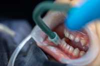 Airflow: moderní dentální hygiena